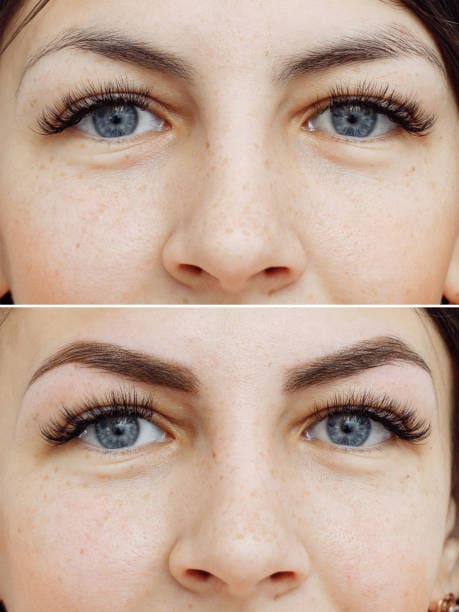 Brow Design