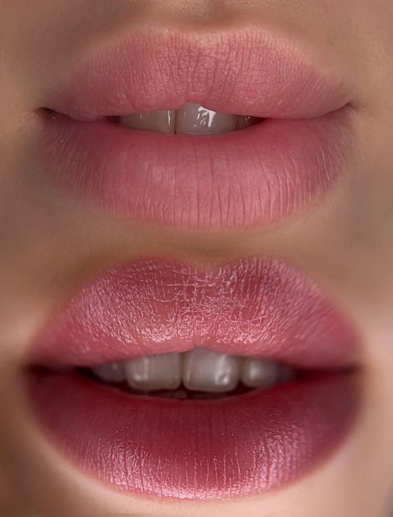 Permanent lip makeup