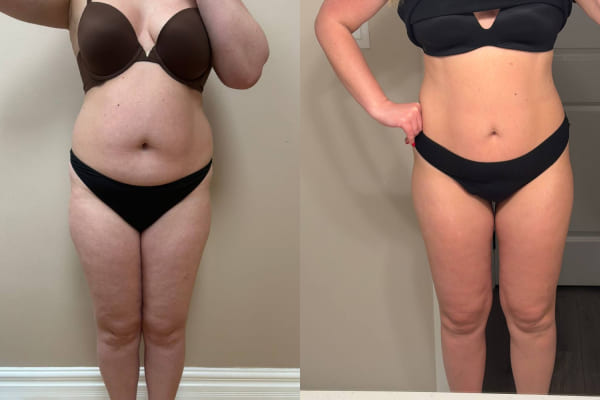 Result after 4 months