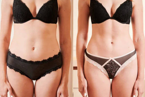Result after 12 weeks