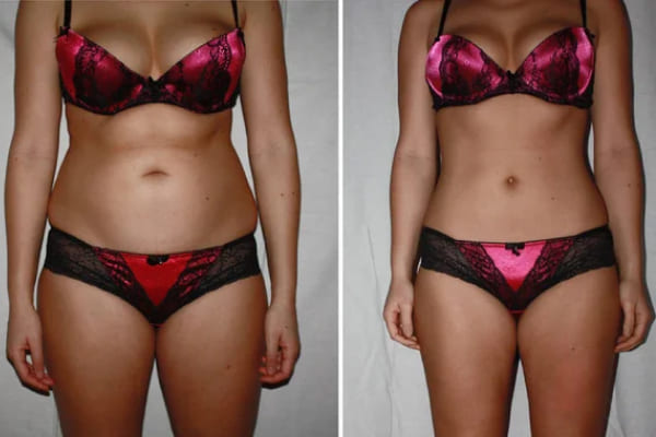 Result after 16 weeks