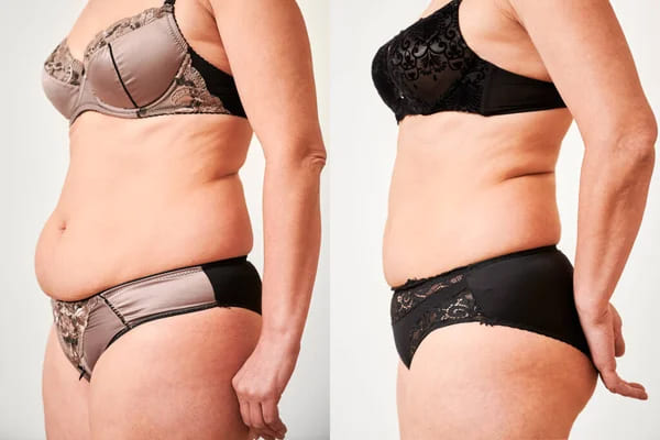 Result after 12 weeks