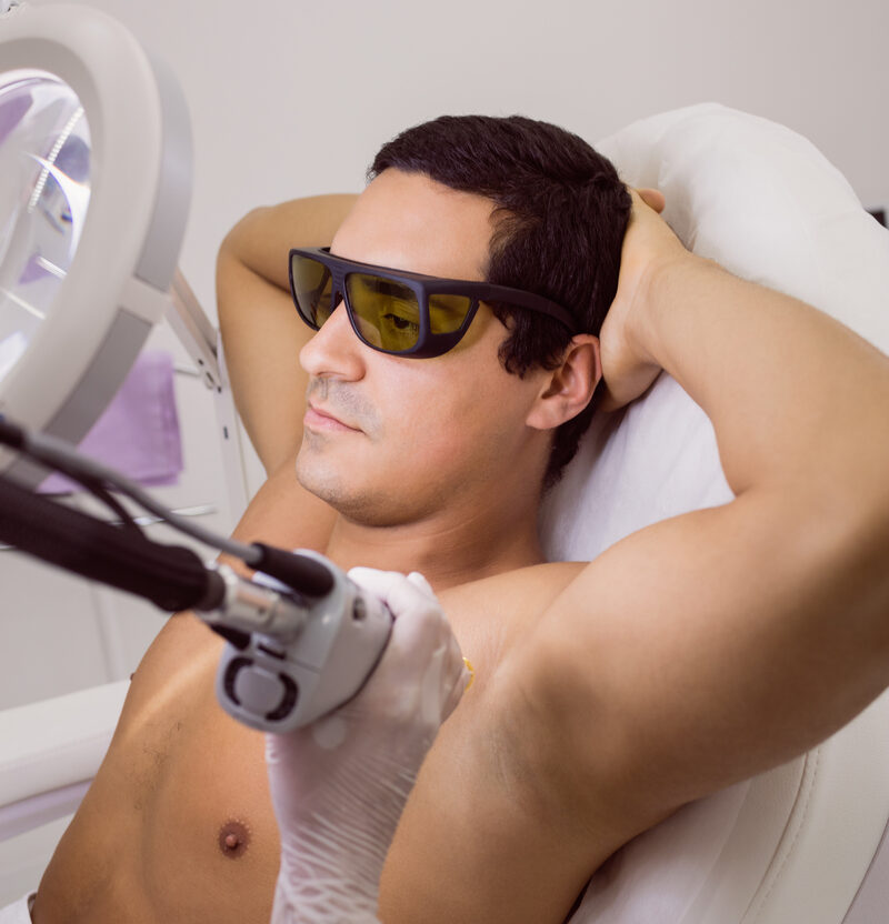 Laser Hair Removal for Men